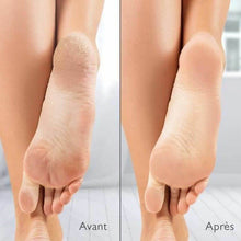 Electric Callus Remover Silk´n Vacupedi (5 kosov) - Shopper.si